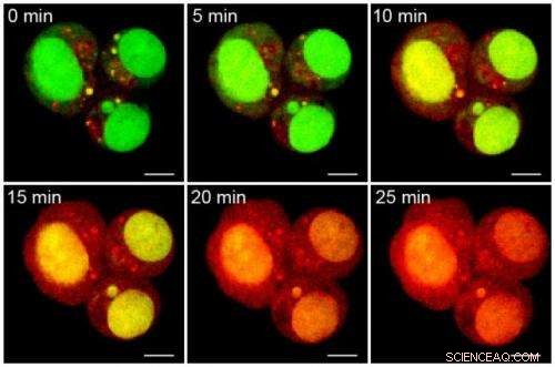 MIT Engineers Develop Nanoparticles That Deliver Triple Cancer Therapy