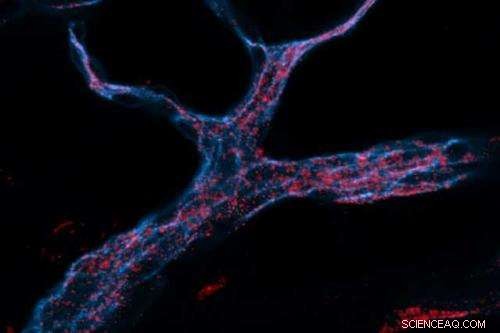 Nanoparticle-Delivered RNA Silences Genes Across Organs – A Promising Cancer Treatment