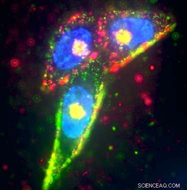 Precision Tumor Targeting with Silver Nanoparticles: A New Frontier in Oncology