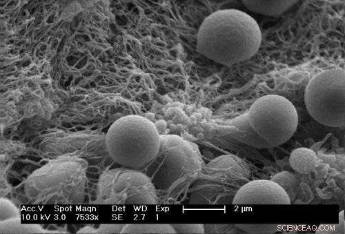 Nanoparticle-Based Clotting Therapy Significantly Improves Survival After Blast Injuries