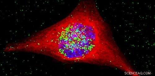 Gold Nanoparticle  Trojan Horse  Therapy Shows Promise Against Aggressive Brain Tumors