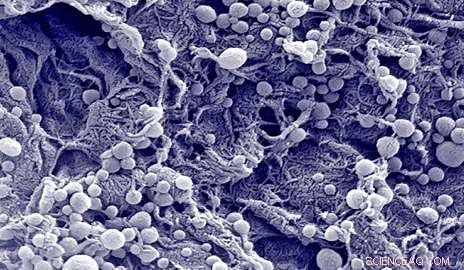 Yale Scientists Boost Cancer Immunotherapy with Nanomaterial-Enhanced Immune Cells