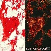 Murdoch University Unveils Advanced Nano-Engineered Bone Matrix