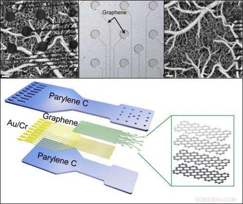 Atom-Scale Graphene Sensors Revolutionize Brain Mapping