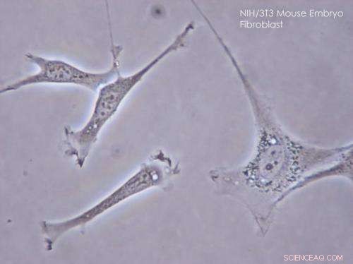 Molecular Beacons Reveal How Cells Crawl