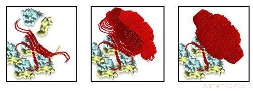 Cell Biology Breakthrough Could Identify Root Causes of Alzheimer’s and Other Neurological Disorders