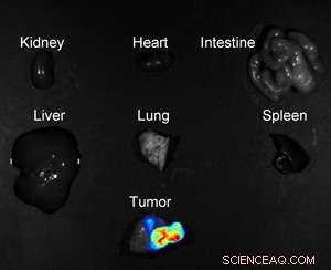 New Fluorescent Nanoprobe Offers Universal, Noninvasive Tumor Detection and Monitoring