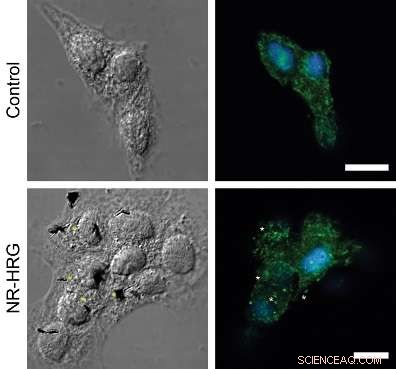 Enhancing Nanoparticle Strategies for Advanced Cancer Diagnosis and Therapy
