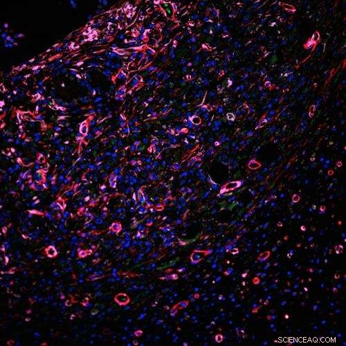 Rice University Unveils Advanced Injectable Scaffold Boosting Internal Healing