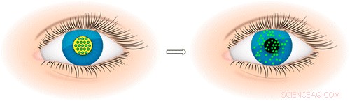 New Wafer Technology Could End the Need for Eye Drops in Treating Eye Injuries