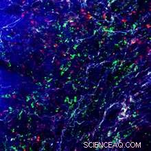 Targeted Lung Cancer Treatment with Nanoparticle Drug Delivery