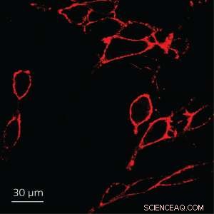 Ultrasonically Synthesized Tiny Conjugated Polyelectrolyte Nanoparticle Probes Outperform Commercial Counterparts