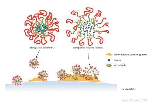 Nanoparticle Drug Delivery System Targets Tooth Decay