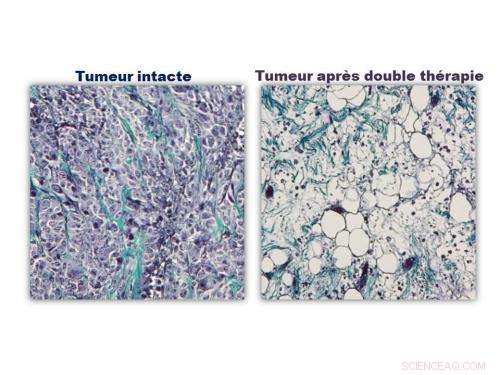 Magneto‑Photothermal Therapy: Harnessing Magnetism and Light to Target Cancer
