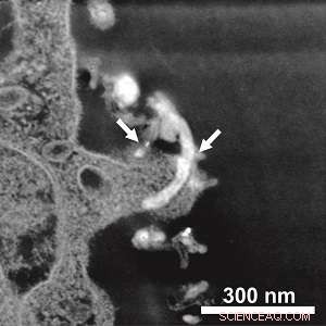 Carbon Nanotubes and the Blood-Brain Barrier: A Comprehensive Interaction Study