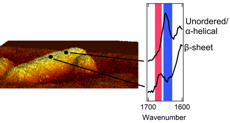 Unveiling Diabetes: Physicists Capture Protein Aggregate Structures Using Advanced Microscopy