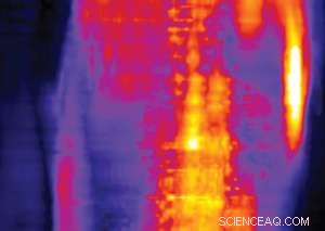 Revealing Breast Cancer Early with Nanoscale Polymer Contrast Agents