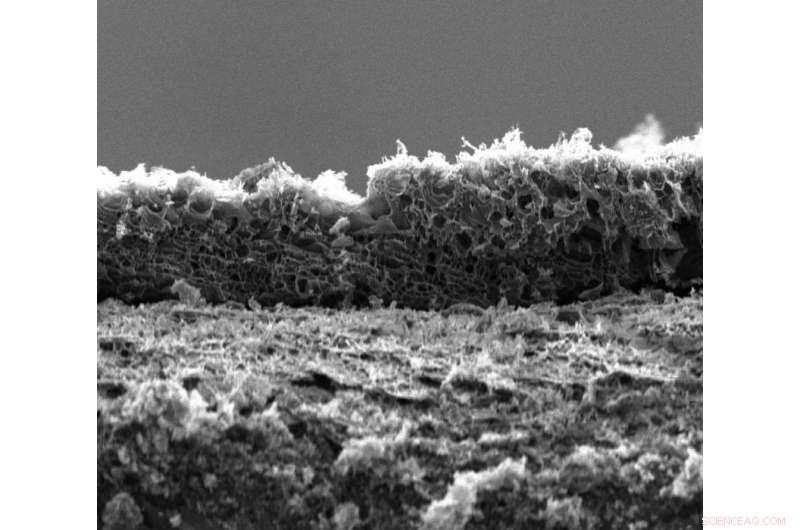 Boron-Infused Graphene Offers a Breakthrough for Wearable Electronics