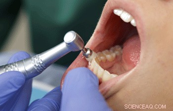 Nanotech Breakthrough: Preventing Deep Bone Infections