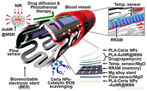 Innovative Electronic Stent Offers Real‑Time Feedback, Therapy, and Safe Dissolution