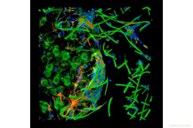 Injectable Electronics Offer New Horizons in Neuroscience and Neurodegenerative Disease Treatment