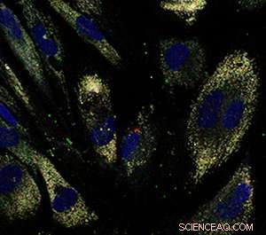 Nanoparticle System Enables Accurate Tracking of Anticancer Drug Delivery into Cells