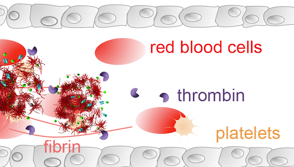 Innovative Nanotech Clot-Busting Therapy Aims to Curb Leading Cause of Death