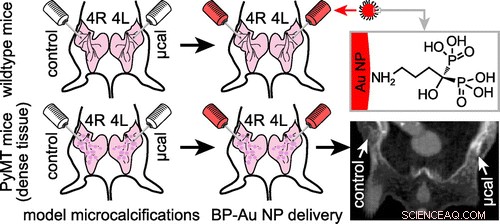 Innovative Gold Nanoparticle Technique Enhances Mammogram Accuracy for Dense Breast Tissue