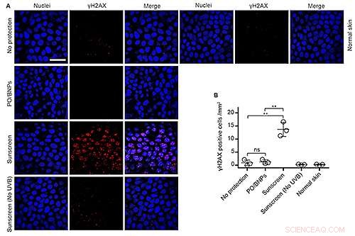 Yale Unveils Sunscreen That Stays on Skin—No Penetration, No Health Risks