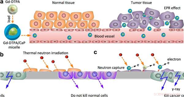 Gadolinium-Based Micelles Target and Treat Tumors Using Neutron Capture Therapy