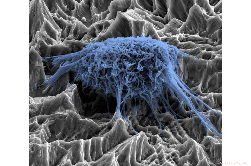 Preventing Infections in Dental Implants: Best Practices & Guidelines