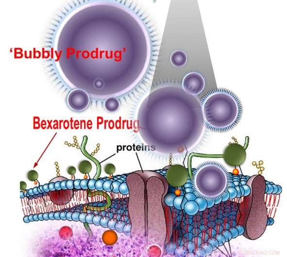 Innovative Nano‑Bubble Therapy Combines Drug Delivery, Ultrasound Ablation, and Immunotherapy for Liver Cancer