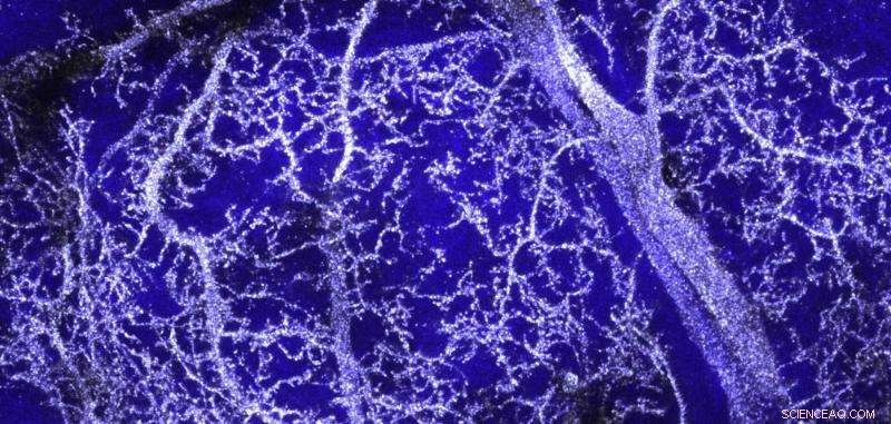 Revolutionary 3‑D Imaging Unveils Stunning Details of Metal‑Labeled Neurons