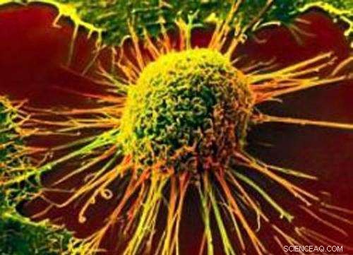 Plant Virus Shells Activate Immune System to Destroy Tumors and Halt Metastasis