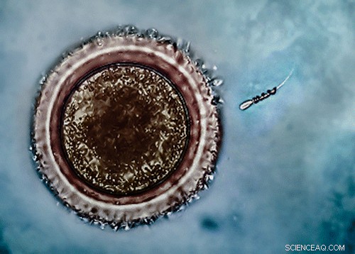 Spermbots: New Tech Boosts Sperm Motility to Aid Fertility