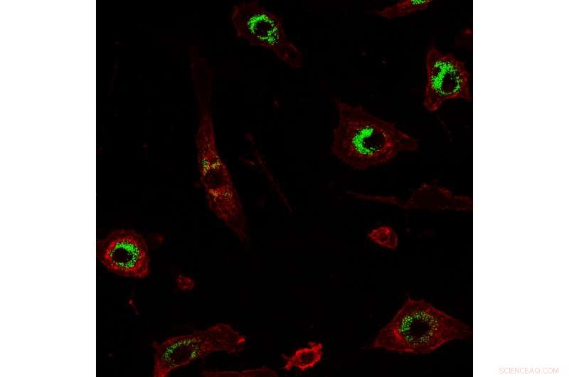 Researchers Identify How Nanoparticles Undermine Immune Cell Function