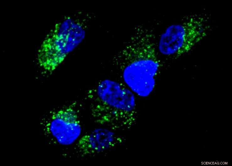 Scientists Showcase Fundamental Nucleic Acid Computing Inside Living Cells