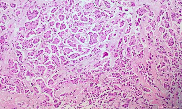 Advanced Sensors Detect Tumor Spread During Surgery, Reducing the Need for Follow‑Up Cancer Operations