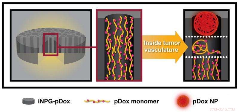 Injectable Nanoparticle Generator Promises Breakthrough in Metastatic Cancer Therapy