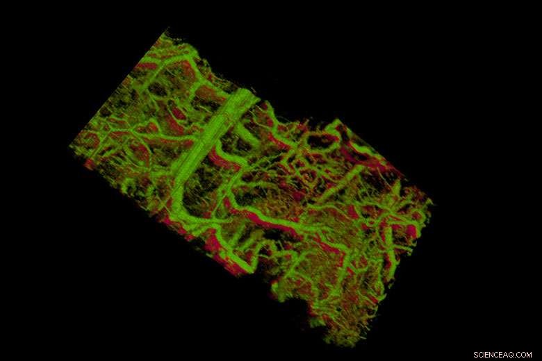 New Imaging Technique Reveals Subcutaneous Cells and Tissues in Real-Time