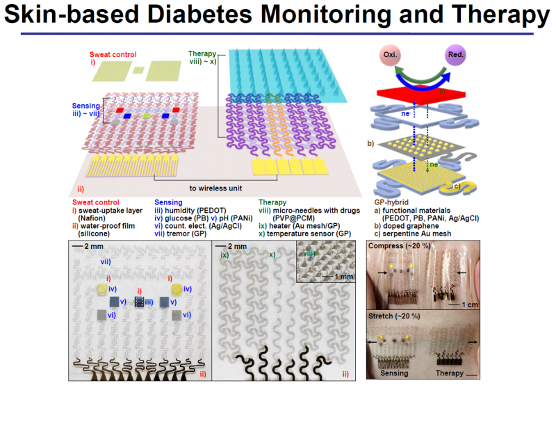 Graphene‑Based Wearable Device for Continuous Diabetes Monitoring and Management