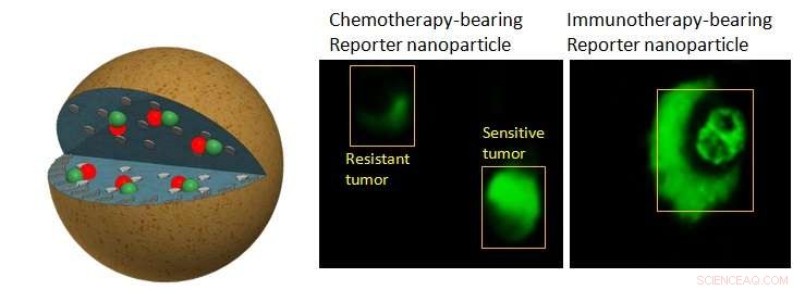 Real‑Time Nanoparticle Imaging Distinguishes Drug‑Sensitive from Drug‑Resistant Prostate Tumors