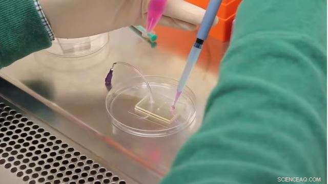 Engineered Blood Vessel Model Paves Way for Advanced Precision Medicine