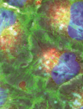 Carbon Nanotubes: A Cutting-Edge Platform for Targeted Drug Delivery