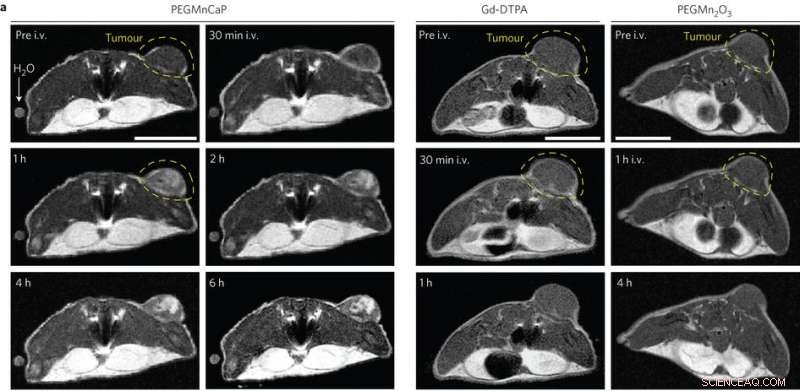 pH‑Responsive Nanoparticle Contrast Agent Enhances Tumor MRI Visibility