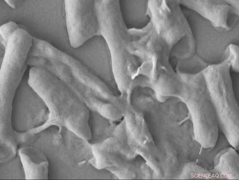 Revolutionary Antimicrobial Material Eliminates E. coli in 30 Seconds