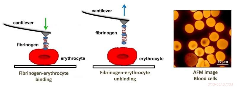 Atomic Force Microscopy Reveals a Novel Heart Disease Biomarker