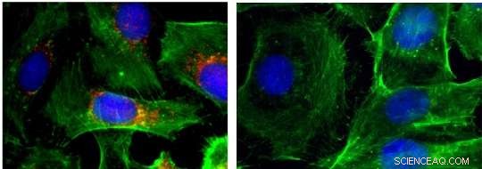 Breakthrough Nanoparticle Therapy Targets Aggressive Thyroid Cancer