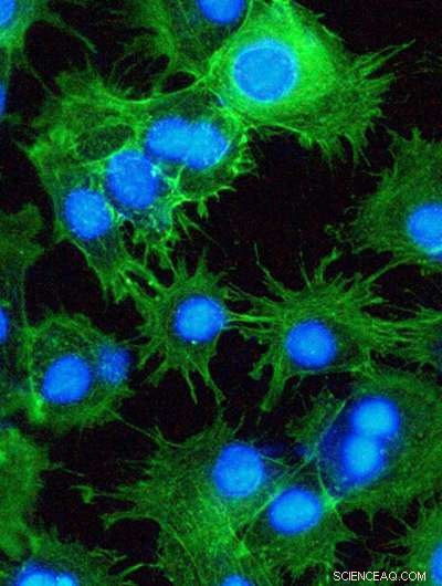 Innovative Nanofiber Scaffolds Reveal Novel Stem and Cancer Cell Behaviors