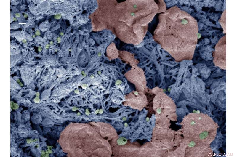 Engineered Nanoparticles Accelerate Blood Clotting—Potential Life‑Saving Breakthrough in Trauma Care